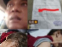 Viral .. !! Anggraini Berjuang Sendiri Obati Anak diduga Derita Tumor dan Penyakit Kulit, Ayah Biologis Didesak Tanggungjawab